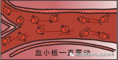血小板是正常值的三倍？專家提醒小心血栓和出血！