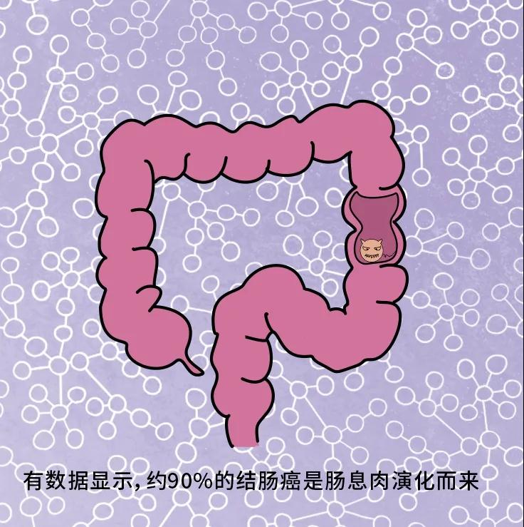 奪走“黑豹”生命的結(jié)腸癌，到底什么來頭？