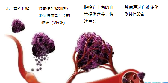 晚期腫瘤為什么會(huì)復(fù)發(fā)轉(zhuǎn)移？
