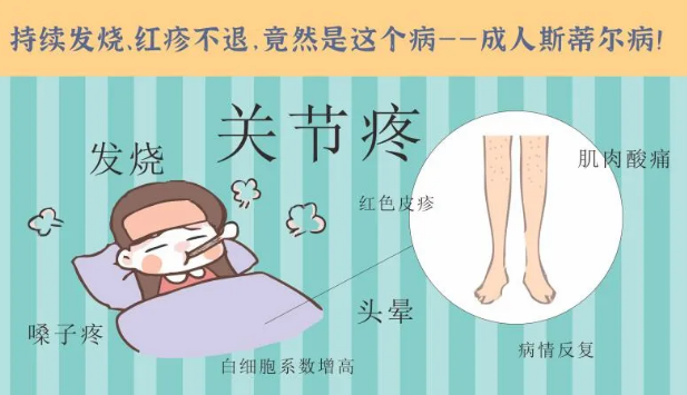 持續(xù)發(fā)燒、紅疹不退……她終于在這里治好了這個(gè)罕見(jiàn)病
