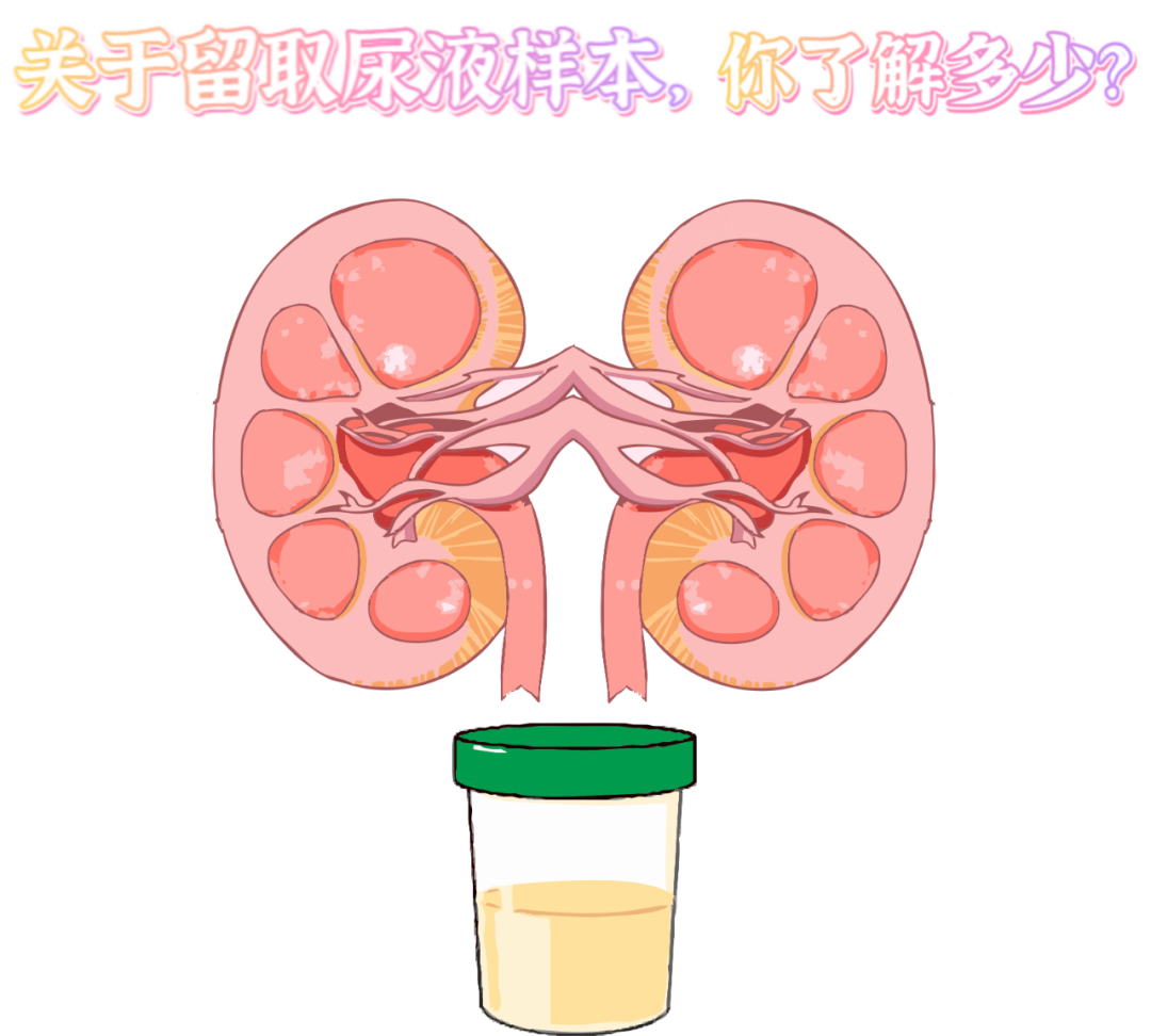 做尿檢，不得不說(shuō)的注意事項(xiàng)！