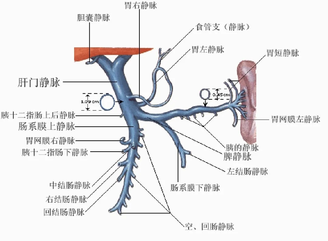 反復(fù)嘔血、黑便怎么辦？TIPS手術(shù)能解決