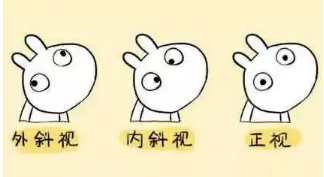 小baby老歪著頭？警惕斜頸! 這樣糾正……