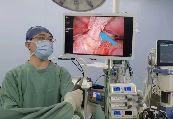 30歲小伙持續(xù)發(fā)燒咳嗽，原來是多長一塊肺......