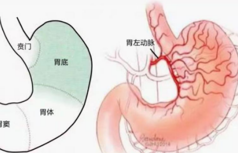 不開刀不吃藥不餓肚子，微創(chuàng)介入減肥靠譜嗎？