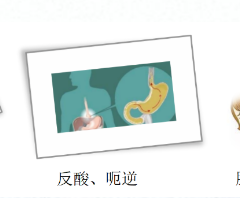 關(guān)愛身體健康，輕松檢查胃腸