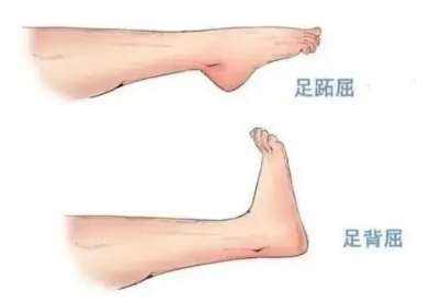 扭胯小連步、動感搖花手……“科目三”雖火，運動損傷也要防！