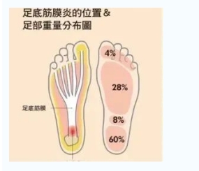 每年新生數(shù)百萬足底筋膜炎患者！國際醫(yī)學(xué)專家提醒：跑步要選擇合適的鞋